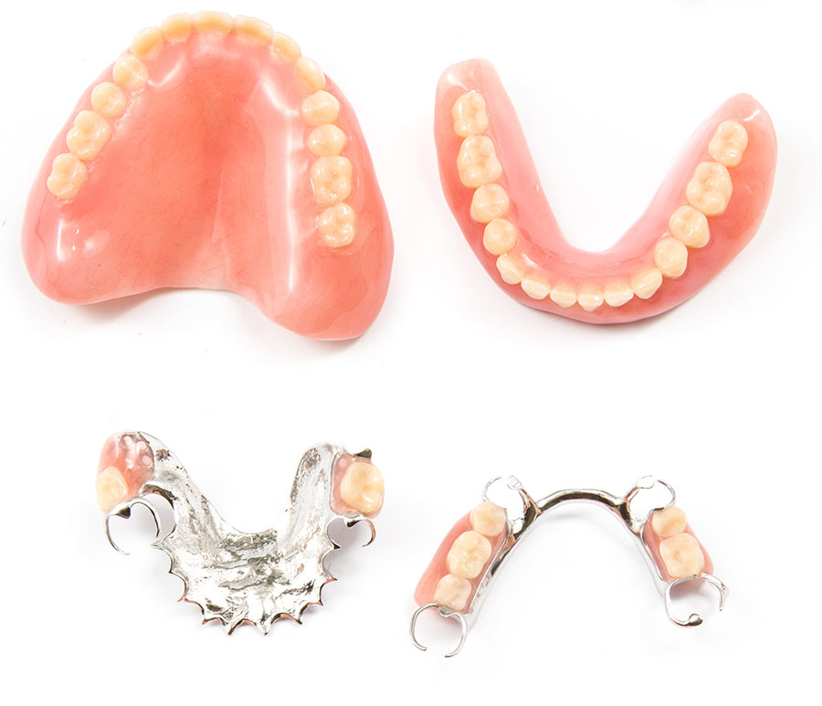naast Productiviteit leider Uw kunstgebit herstellen – Dentaalfix
